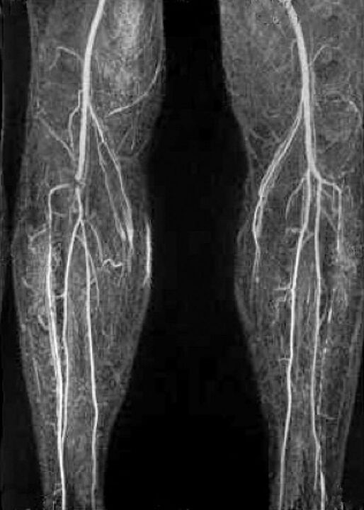 Vaskular x -ray