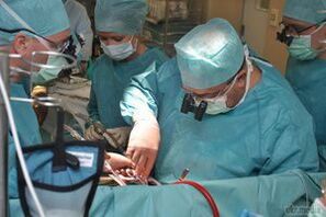 chirurgesch Behandlung vun Krampfadern vum Becken